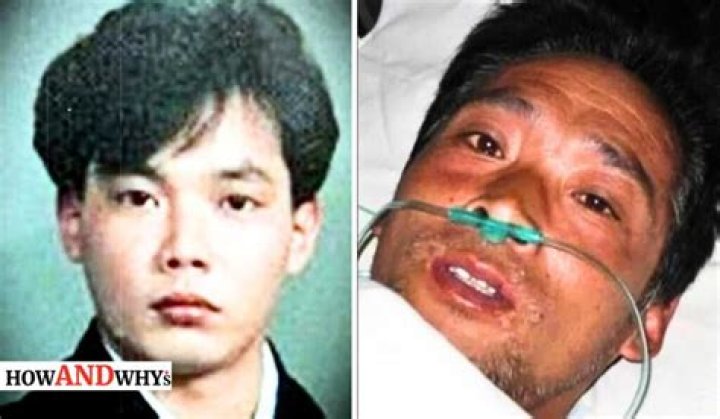 Hisashi After Radiation: A Journey Of Resilience And Recovery