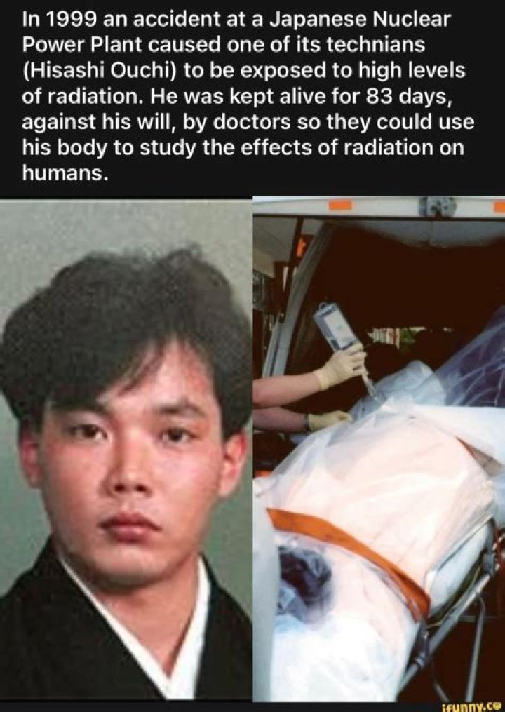 **The Life And Struggles Of Hisashi Ouchi After Radiation Exposure**
